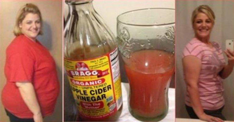 Apple Cider Vinegar Weight Loss Cnn
 How To Lose Stomach Fat Overnight literally with this so