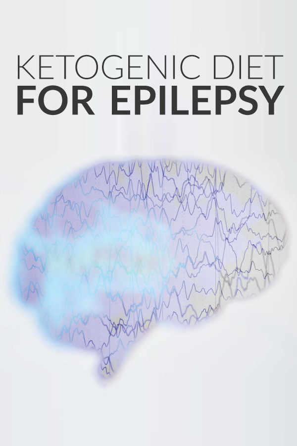 Keto Diet And Epilepsy
 The Ketogenic Diet for Epilepsy How It Can Help