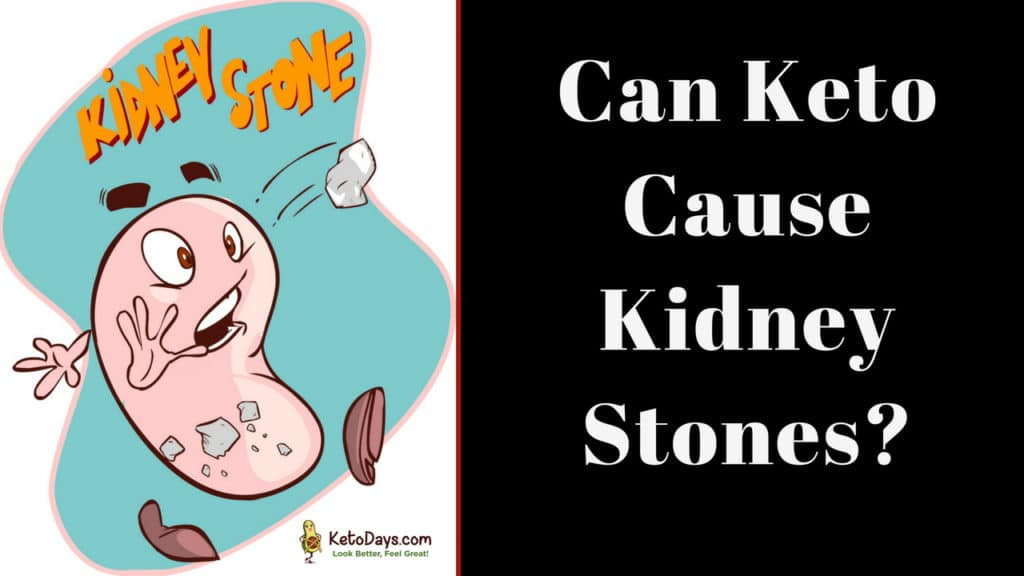 Keto Diet And Kidney Stones
 Can The Keto Diet Create Kidney Stones