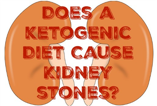 Keto Diet And Kidney Stones
 Does a Ketogenic Diet Cause Kidney Stones – My Sugar Free