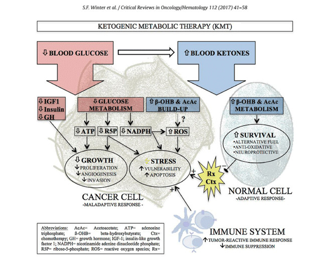 Keto Diet Cancer
 Ketogenic Diet and Brain Cancer