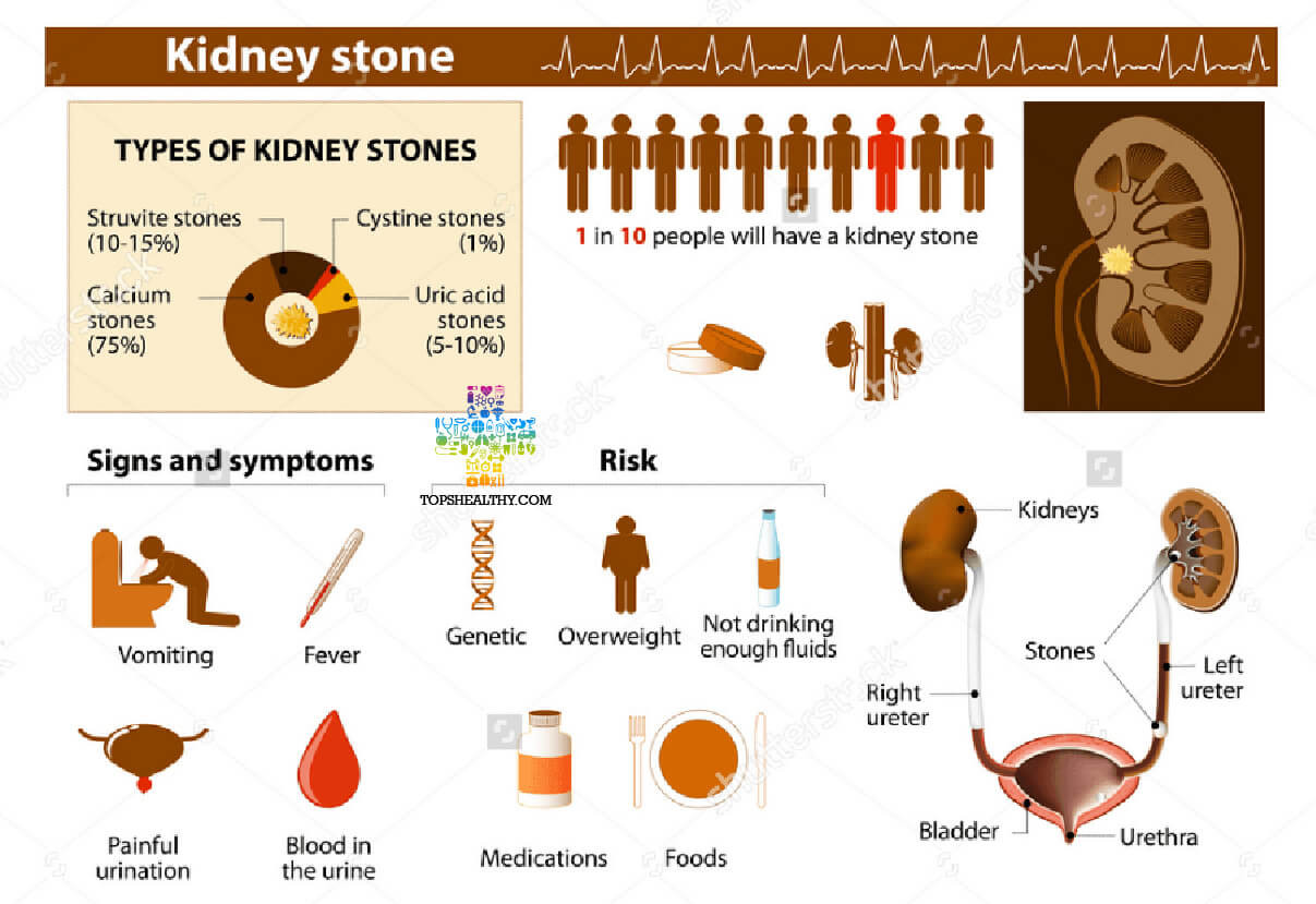 Keto Diet Kidney Pain
 Ketogenic Diet And Kidney Disease