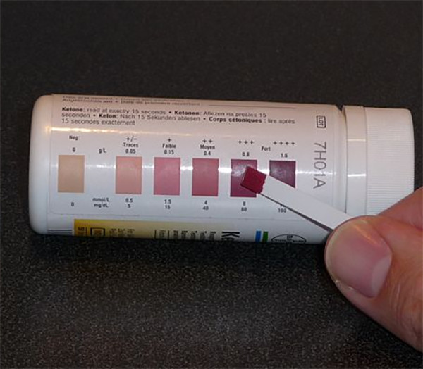 Keto Diet Strips
 Glu Defining Ketones and the Ketogenic Diet