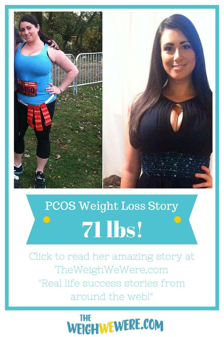 Mediterranean Diet Weight Loss Success Stories
 From PCOS Struggle To PCOS Success My 71 Pound Weight